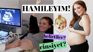 HAMİLEYİM 😍 Cinsiyet Hamilelik Belirtileri 1Trimester Detaylı Ultrason 💕 [upl. by Jorgensen733]