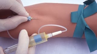 Performing a venipuncture using a butterfly needle [upl. by Winnifred]