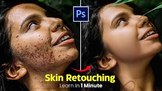 How to remove Acne pimples and blemishes using photoshop  photoshop trending [upl. by Geminian]