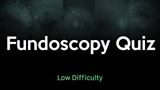 Fundoscopy Quiz Low Difficulty [upl. by Kean]