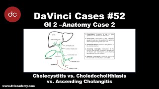 Cholecystitis vs Choledocholithiasis vs Ascending Cholangitis DaVinciCases GI 2  Anatomy Case 2 [upl. by Godding]