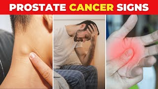 The Most Critical Signs of Prostate Cancer [upl. by Enitram]