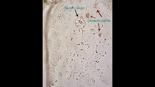 Práctica de la observacion de Plastidios Observation of plastids [upl. by Sanoj]