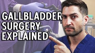 Gallbladder Surgery Explained  Complications and Recovery [upl. by Eirehs96]