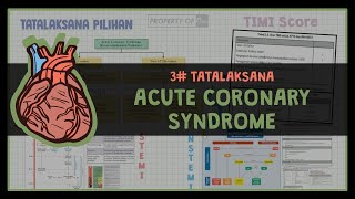 22 TERAPI SINDROM KORONER AKUT 2 ISCHEMIC HEART DISEASE [upl. by Selec]