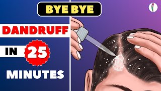 🔥1 Dandruff Treatment at Home  How to get rid of Dandruff  Dandruff Removal  Itchy scalp [upl. by Ahsiliw]