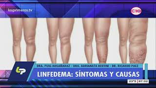 Linfedema qué es Medidas para prevenir y tratar el linfedema [upl. by Nazario584]