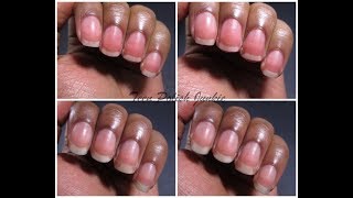 Tes ongles seront durs et vont pousser 2X plus vitepousse extreme des ongles [upl. by Benedicta]