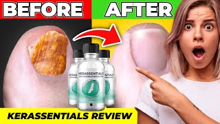 KERASSENTIALS ❌⚠️WATCH OUT⚠️❌ KERASSENTIALS REVIEWS KERASSENTIALS REVIEW KERAESSENTIALS OIL [upl. by Geordie]