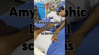 Amyotrophic lateral sclerosis motor neuron disease [upl. by Aerdma871]