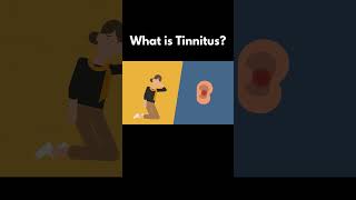 What is Tinnitus [upl. by Cavallaro]