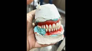 Denture For completely Edentulous Patient [upl. by Goody59]