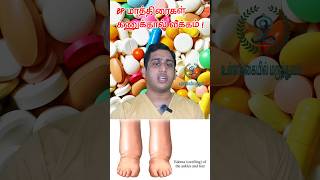 BP மாத்திரைகள்  கணுக்கால் வீக்கம்Amlodipine Pedal edemaAmlodipine SideeffectsPedal edema in BP [upl. by Yelahs]