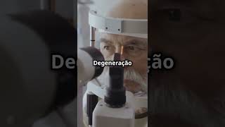 Doenças como a Degeneração Macular afetam milhões de pessoas acima de 50 anos curiosidades [upl. by Nnaassilem47]