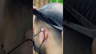 Subscribe Us For More Videos 🔥  Anas Sheikh Hair Solution  wigs hairpatch animalsong [upl. by Ikilisav]