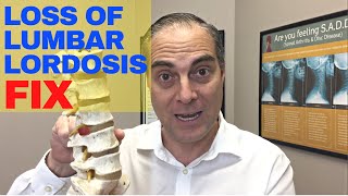 Can Loss Of Lumbar Lordosis Be Fixed Without Surgery  Dr Walter Salubro Chiropractor in Vaughan [upl. by Pattie812]