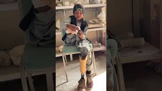 Work artificial prosthesis leg  use below knee prosthesis  child prosthesis legs fitting viral [upl. by Ramo197]