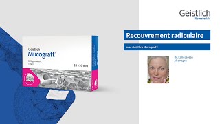 Couverture de récession avec Geistlich Mucograft® [upl. by Dudden]