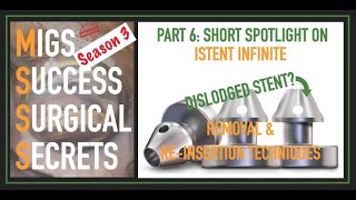 MSSS3 iStent Infinite MIGS Success Surgical Secrets Spotlight on iStent Infinite Reinsertions [upl. by Gerti]