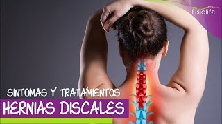 😩 Síntomas y Tratamiento Fisioterapéutico de la Hernia Discal  FISIOLIFE [upl. by Belmonte]