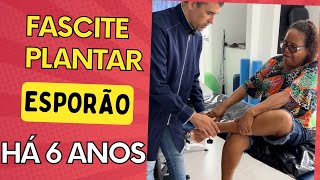 ESPORÃO DE CALCÂNEO E FASCITE PLANTAR  6 ANOS 😱 [upl. by Yevreh731]