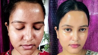 My skin care journey for glass skin15 days skin care journey skincare pimple beauty [upl. by Englis403]