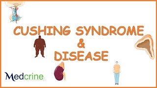 Cushing Syndrome  causes pathophysiology symptoms and treatment [upl. by Moreen347]