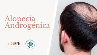 Revisión Alopecia Androgénica [upl. by Fredek]