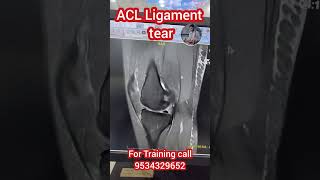 MRI knee ligament injury anatomy shortvideo radiologytechnologist radiological shortreels [upl. by Lederer101]