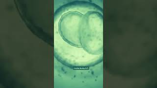 Journey of IVF Embryo Development ivf ivfjourney ivfsuccess [upl. by Nolava]