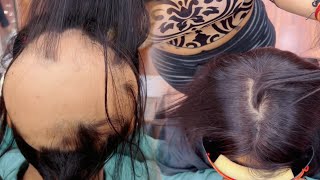 Thin hair  hair extensions  hair wigs  natural hair  Nishalambha ☎️ 8826294776 [upl. by Nisa]