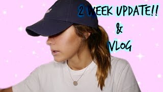 JAW SURGERY UPDATE  FIRST VLOG 2 WEEKS POSTOP  VICTORIA BACHLET [upl. by Milks514]