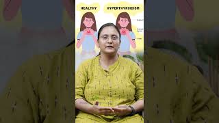 Understanding Bilateral Pedal Edema with Dr Vaishnavi Ganesan  Causes Symptoms and Management [upl. by Torr]