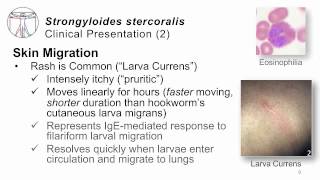 Helminths Strongyloides [upl. by Winnick792]