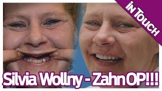 Die Wollnys VorherNachher  Sylvia Wollny zeigt ihr Zähne [upl. by Anh]