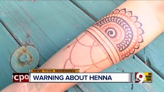 Trying to make your henna tattoo last longer can badly damage your skin [upl. by Lenci844]