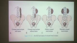 Embryology of the Urogenital System lecture  Urology  surgery  6th grade [upl. by Ransell]