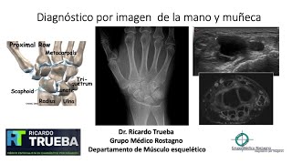 DIAGNOSTICO POR IMAGENES DE LA MANO Y MUÑECA [upl. by Kidder936]