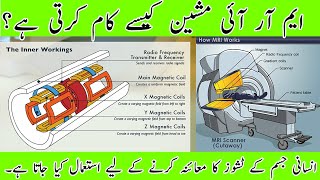 How does an MRI machine work [upl. by Nedra]