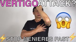 How to a stop menieres disease vertigo attack [upl. by Abott]