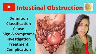 Intestinal obstruction in Hindi Definition Cause Symptom Investigation Tt DrShipra Mishra [upl. by Wattenberg868]