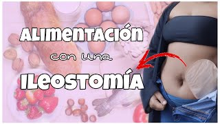 Ostomía  Ileostomía y como evacuar menos con los Alimentos  Mini video [upl. by Nolana915]