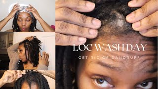 Dry Itchy Scalp Care On Locs  How I get rid of dandruff scales amp flakes with locs  Wash Day [upl. by Lunnete292]