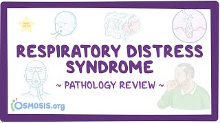 Respiratory distress syndrome Pathology Review [upl. by Lahsiv]