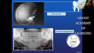 PRINCIPLES OF RADIOGRAPHIC INTERPRETATION [upl. by Ruelu]