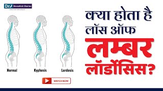 क्या होता है Loss of Lumbar Lordosis Spine Treatment In Noida DelhiNCR amp AgraDr Devashish Sharma [upl. by Garald]