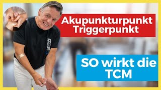 Akupunktur und Triggerpunkte – so wirkt TCM 😳 [upl. by Pond522]