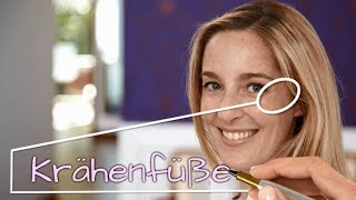 Botox Augenfalten Krähenfüße – Video Dr Günther – Experte für Botox Hyaluron und Laser [upl. by Htebzil143]