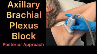 Axillary Brachial Plexus Block  posterior approach step by step easy and simple [upl. by Ynoble]