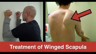 BEST Winged Scapula Exercises Fix Scapular Winging Treatment  Serratus Anterior Exercises [upl. by Noved363]